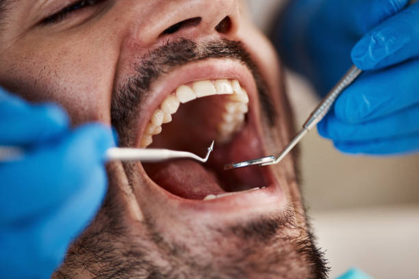 Best Weekend Emergency Dentist in West Lafayette, OH